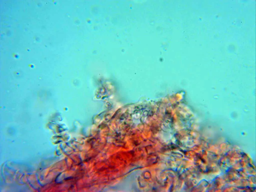 Microscopía de Marasmiellus graminis - 10 - Suprapellis